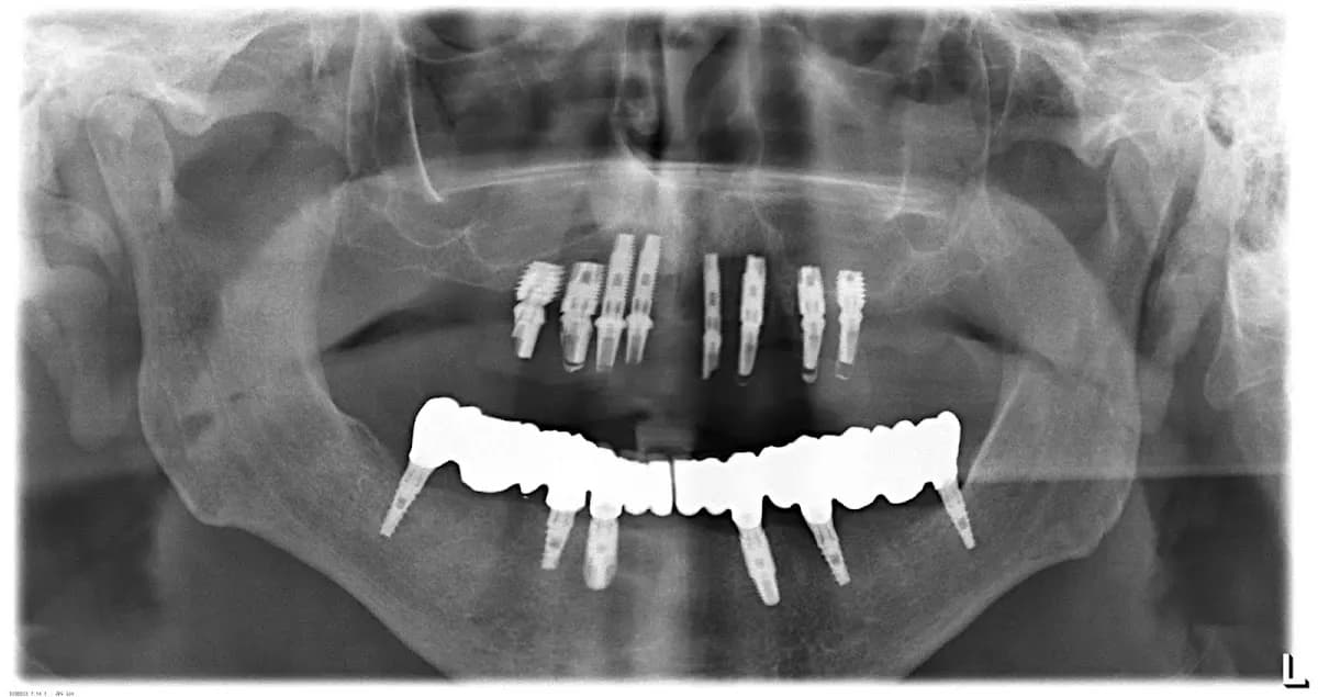 Ihr Zahnarzt in Französisch- Buchholz 13127 Dr. Springer Implantate, Narkose, 60plus — Foto aus dem Google-Eintrag der Praxis