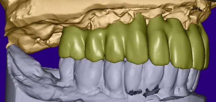 Ihr Zahnarzt in Pankow: Dr. Springer: Implantate, Narkose, Generation 60 plus — Foto aus dem Google-Eintrag der Praxis