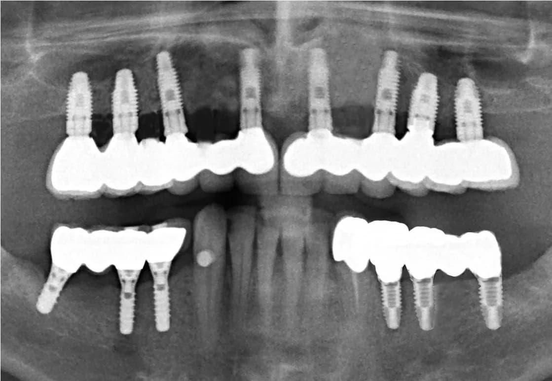 Ihr Zahnarzt in Pankow: Dr. Springer: Implantate, Narkose, Generation 60 plus — Foto aus dem Google-Eintrag der Praxis