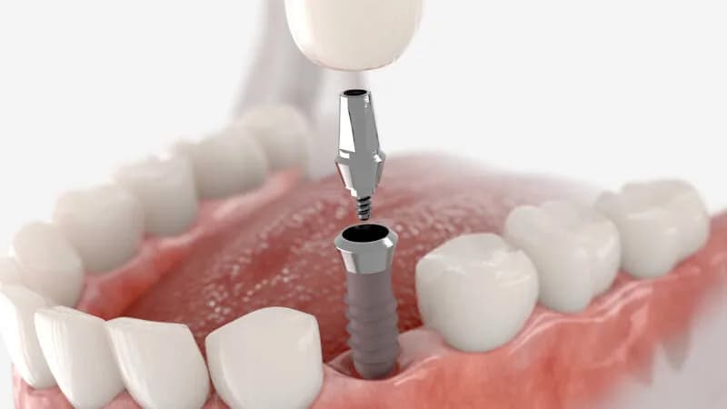 Oralc Oralchirurgie & Implantologie Zahnärzte Friedrichshain - Kreuzberg — Foto aus dem Google-Eintrag der Praxis