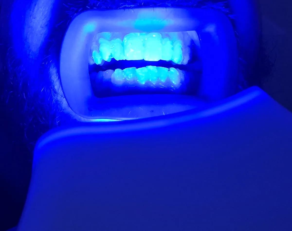 Smile Bright Düsseldorf - Zahnaufhellung — Foto aus dem Google-Eintrag der Praxis