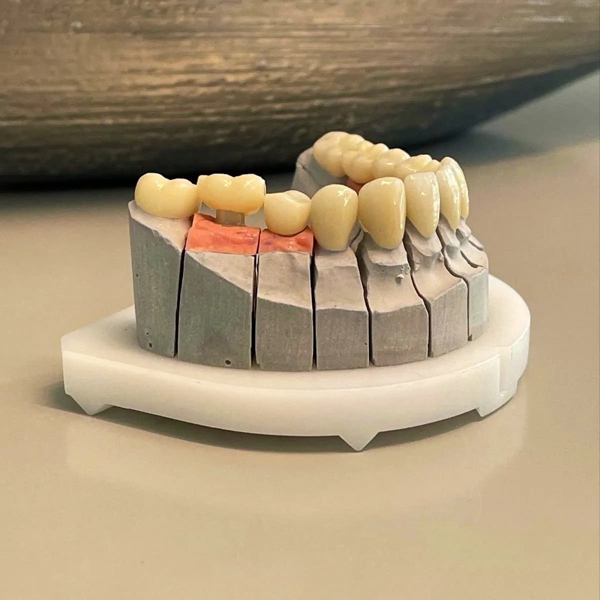 Zahnarztpraxis Vassilij Ochinko - Ihr Zahnarzt Augsburg | Wurzelbehandlung, Implantate, Zahnersatz. — Foto aus dem Google-Eintrag der Praxis